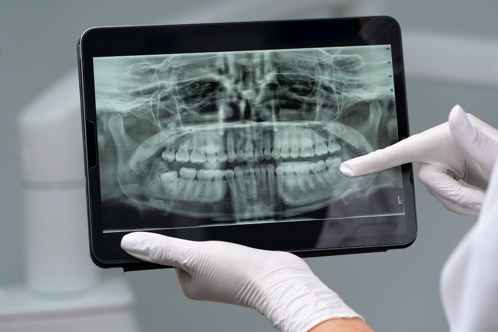 Digital X-Rays  Colchester, VT
