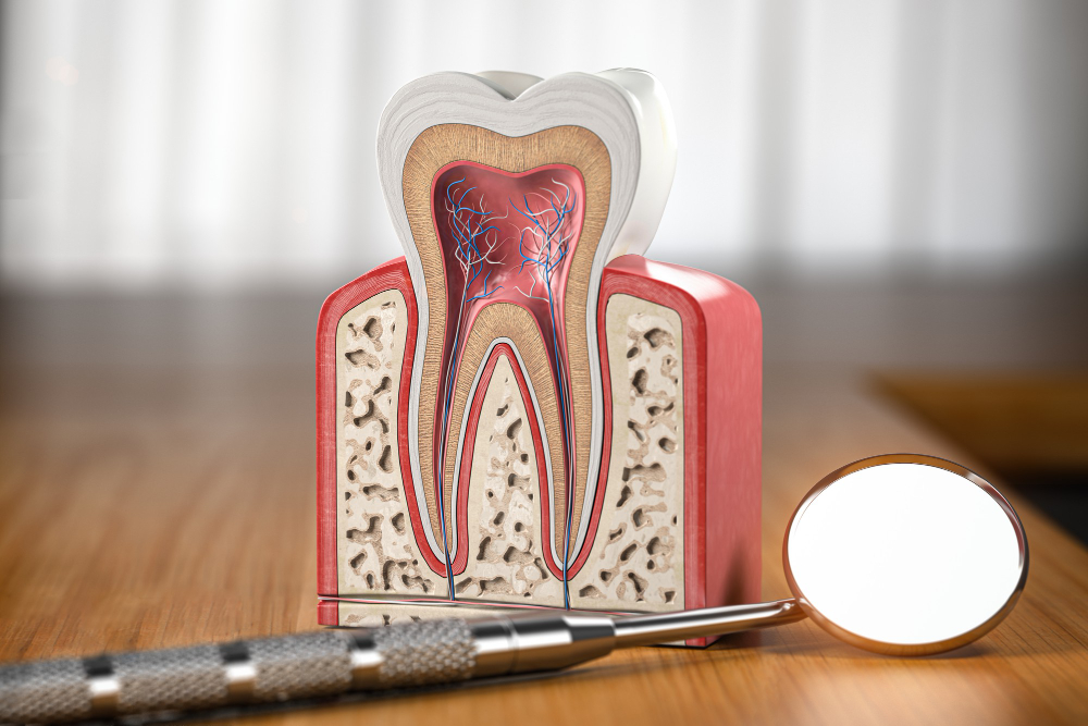 Root Canals  Colchester, VT